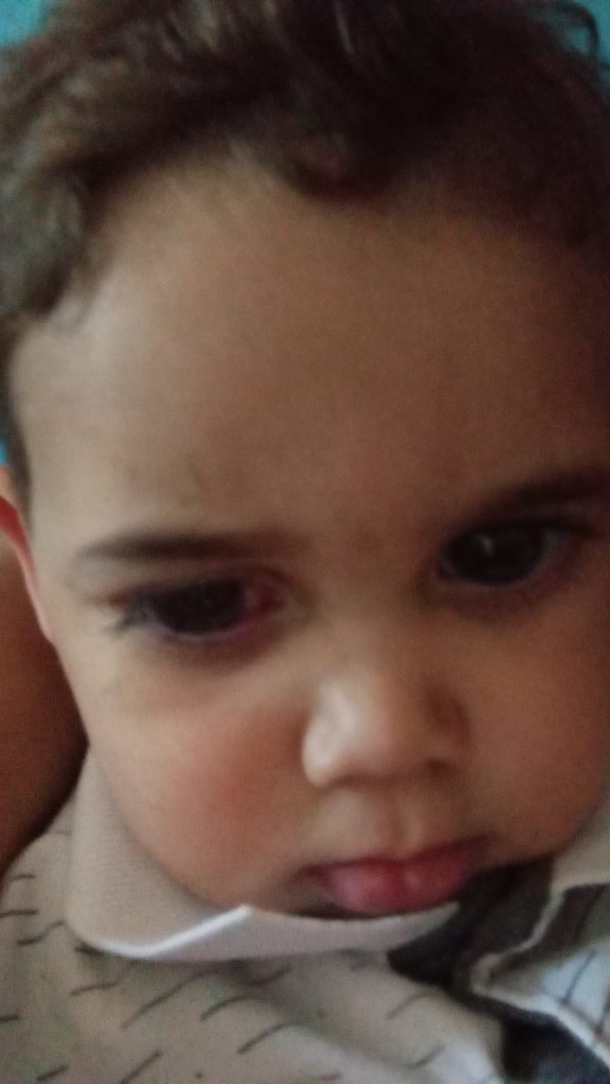 Bebê de Umuarama consegue fazer cirurgia para não ficar cego, após reportagem do Ilustrado