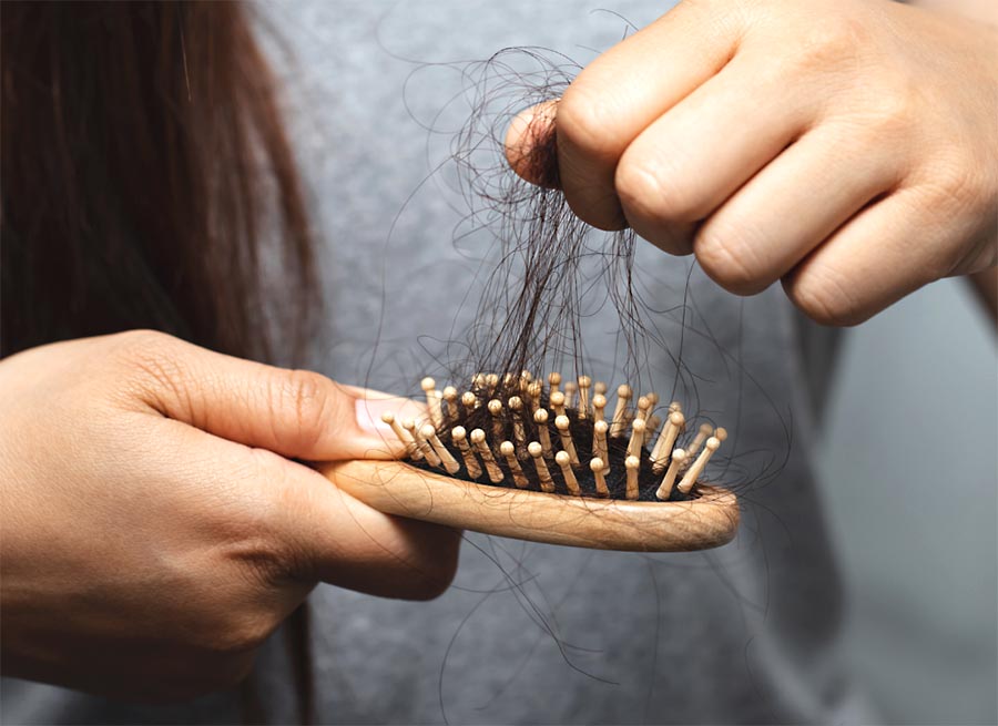 Jornal Ilustrado - Queda de cabelo: Veja algumas soluções para este problema