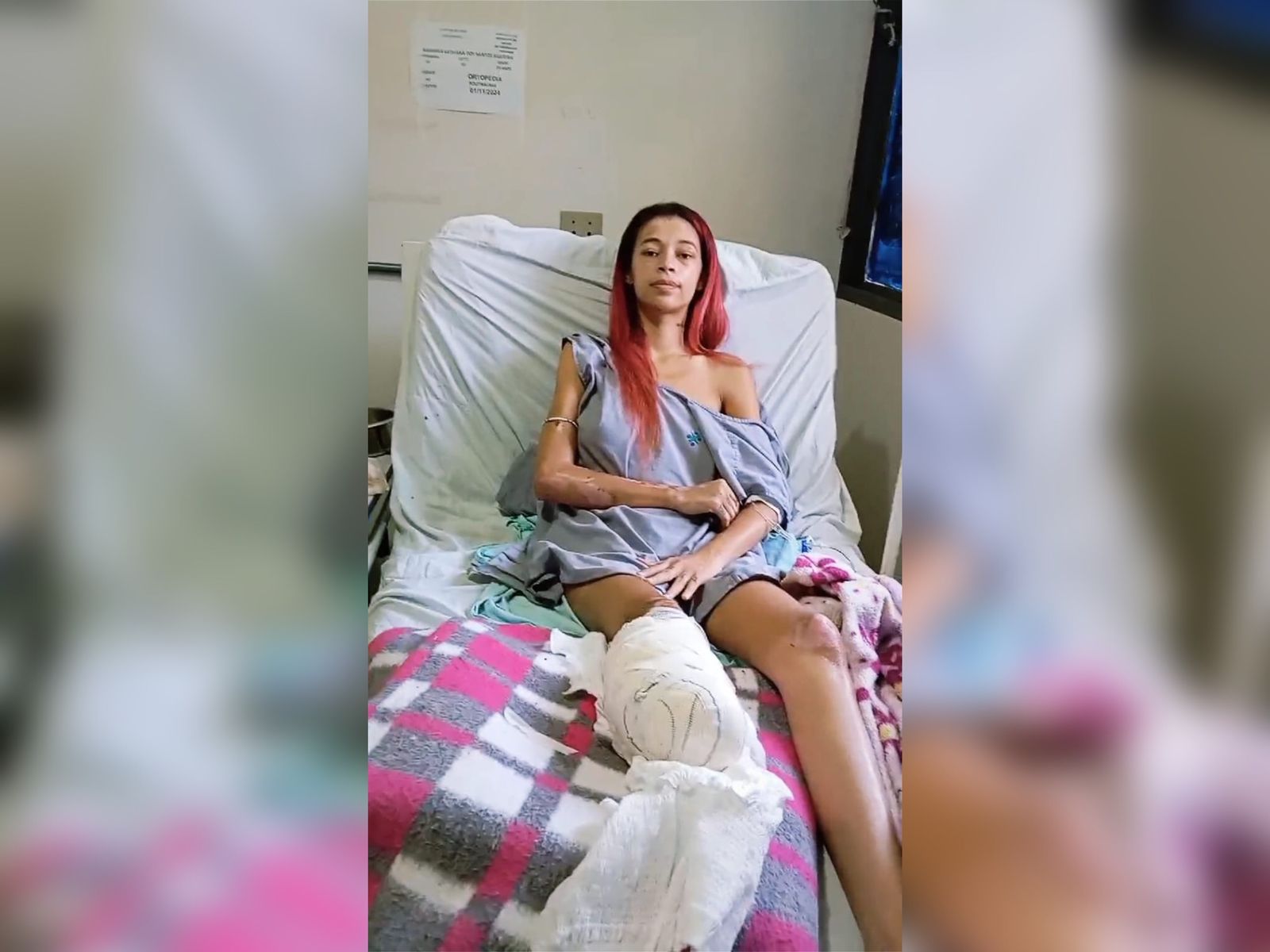Jovem de Umuarama faz rifa solidária para custear tratamento após perder perna em grave acidente