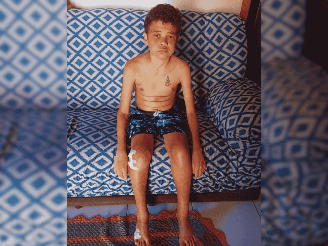 Morador de Casa Branca conta com venda de rifa para tratamento de saúde -  Jornal Ilustrado