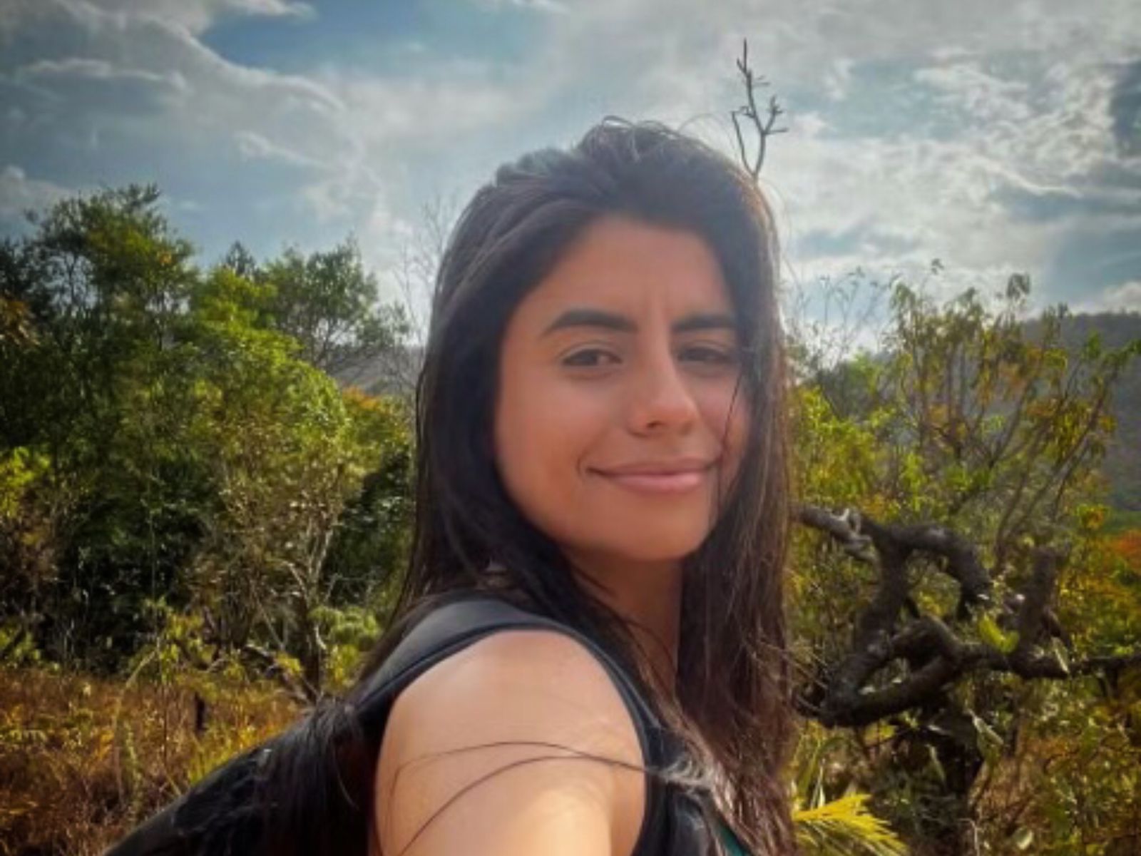 ‘A pele coça, sinto muito calor’, diz advogada que teve 63% do corpo queimado em incêndio no PR